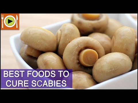Best Foods to Cure Scabies | Including Vitamins, Antioxidants &amp; Zinc Rich Foods