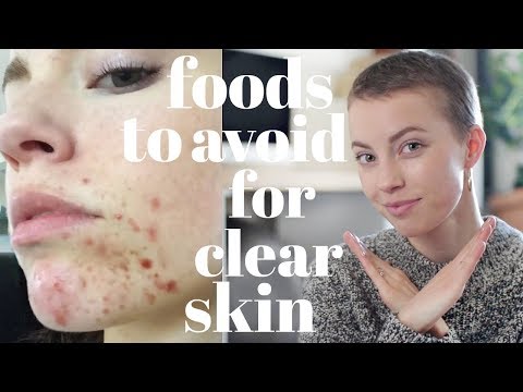 Foods To AVOID For Clear Skin