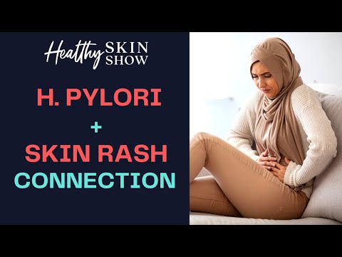 H. pylori-Skin Rash CONNECTION | Jennifer Fugo