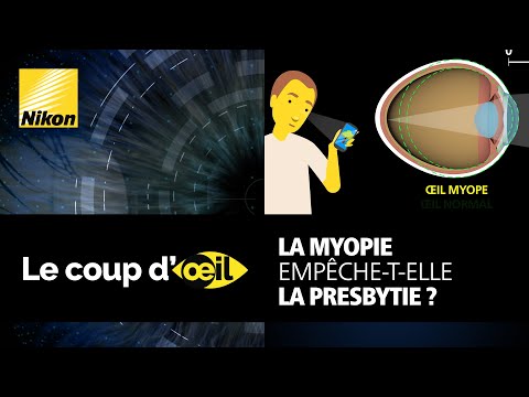 La myopie empêche-t-elle la presbytie ?