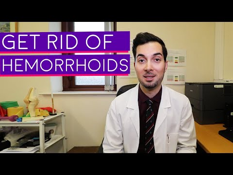 Hemorrhoids | Piles | How To Get Rid Of Hemorrhoids | Hemorrhoids Treatment