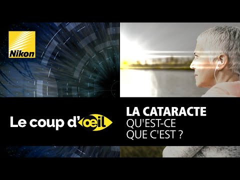 La cataracte, qu&#039;est-ce que c&#039;est ?