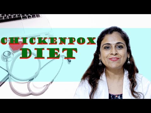 ChickenPox - Doctor Explains | Chickenpox - Food to Eat &amp; Food to Avoid | Mera Doctor