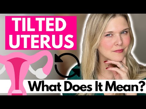 TILTED UTERUS: What Is a Tilted Uterus? How Does Your Uterus Position Impact Fertility?