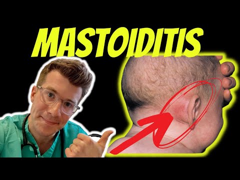 Doctor O&#039;Donovan explains Mastoiditis - including anatomy, symptoms, diagnosis and treatment!