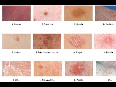 Skin Lesions with defination