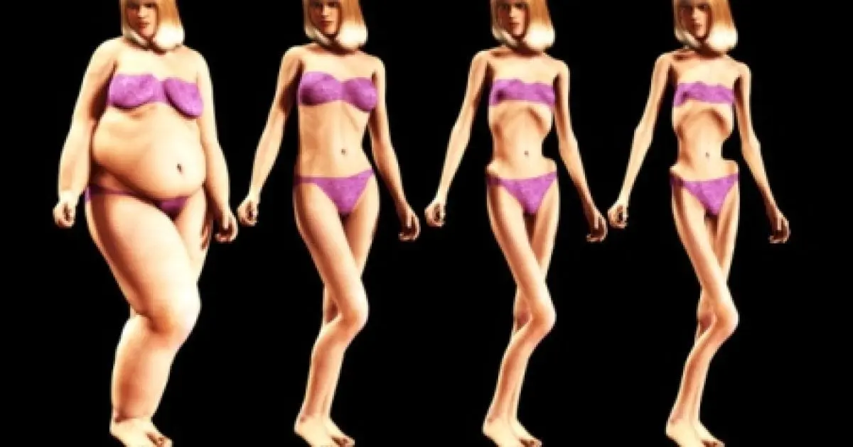 Eating disorders: anorexia