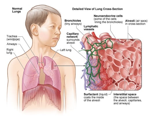 Alvéolite des poumons