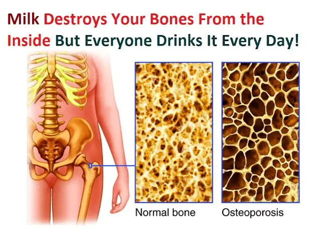 Cow&#8217;s milk destroys our bones