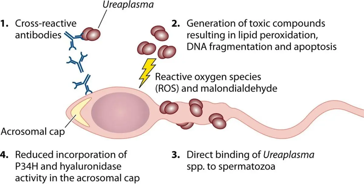 Nutrition with ureaplasma