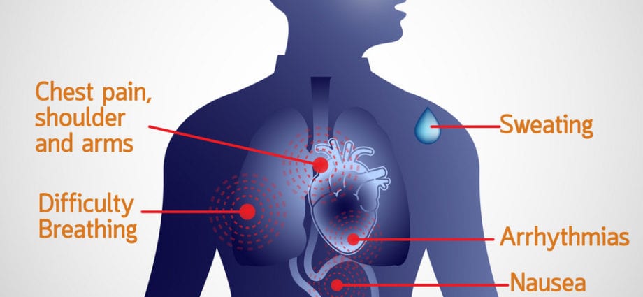 Heart disease symptoms