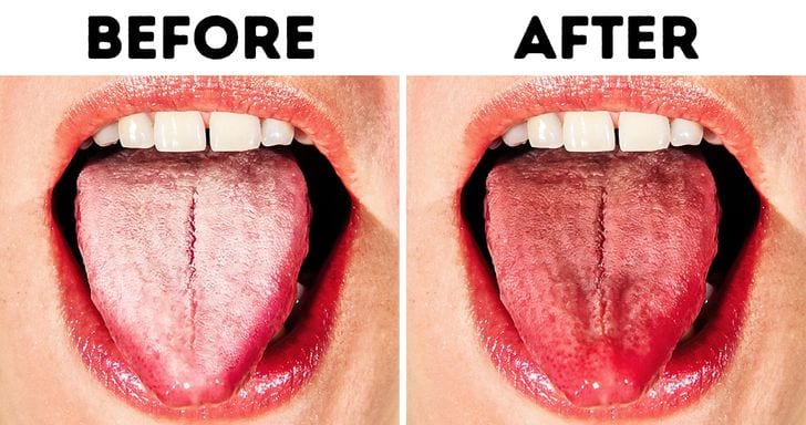 how-to-clean-your-tongue-after-boiling-healthy-food-near-me