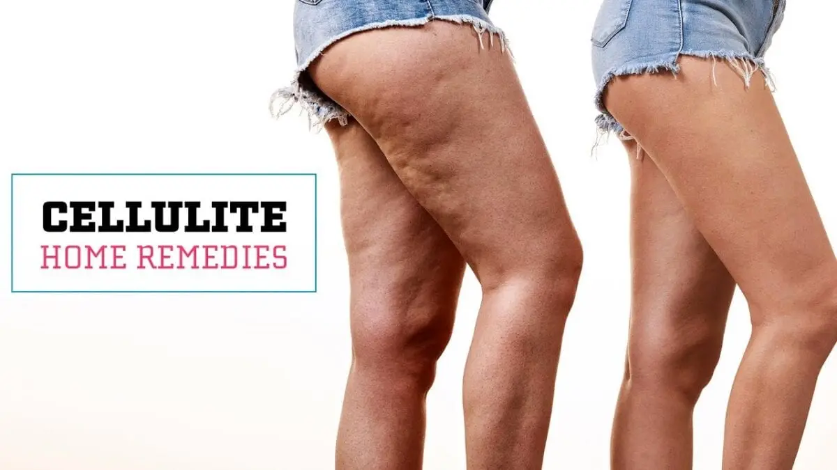 How to get rid of cellulite