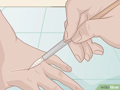 How to prepare a scar