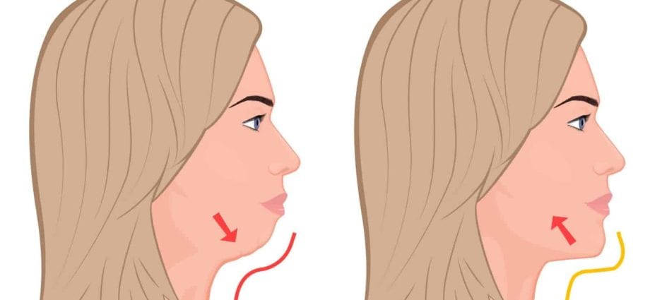 How to remove a double chin, bruises under the eyes, improve skin tone