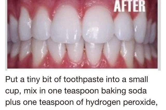How to whiten teeth at home