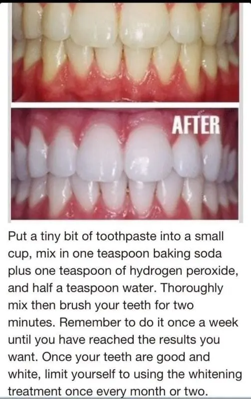 How to whiten teeth at home