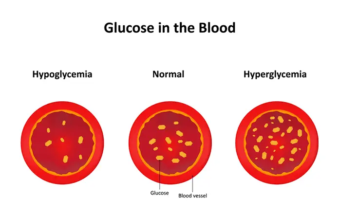 Hypoglycaemia