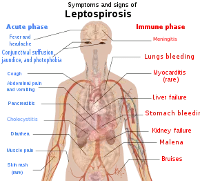 Leptospirosis