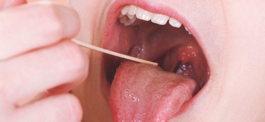 Nutrition for the tonsils