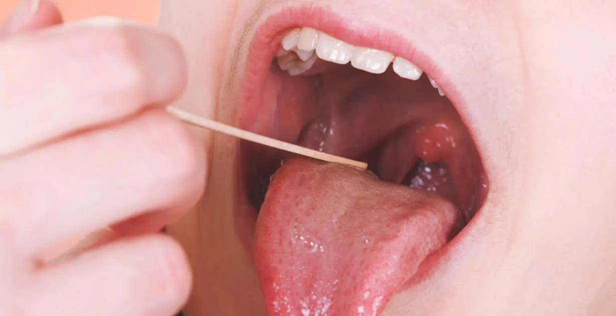 Nutrition for the tonsils