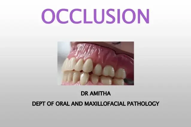 Occlusion