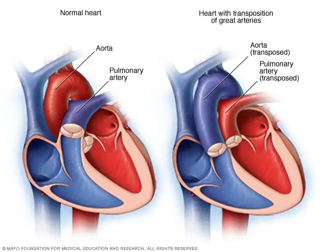 Organ transposition