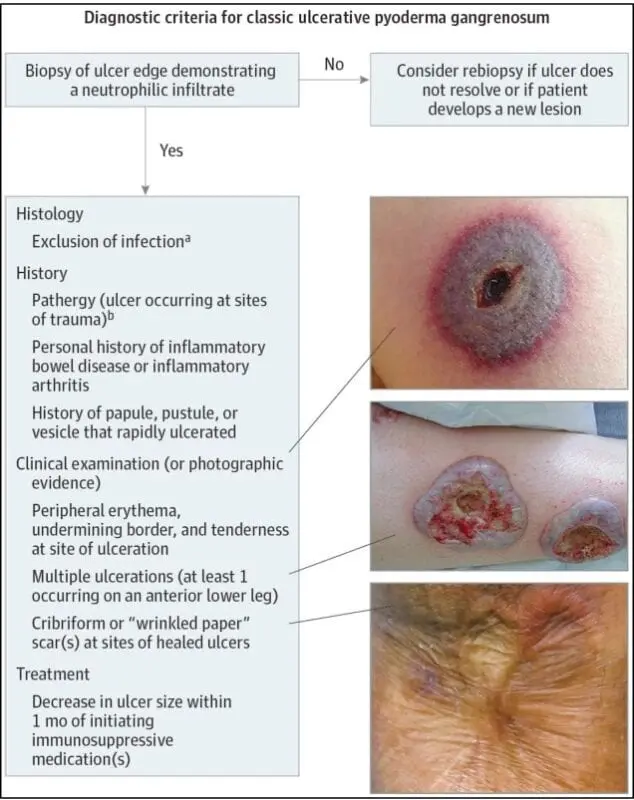 Pyoderma