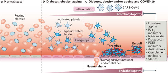 Thrombocytopathy