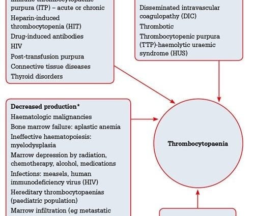 Thrombocytopenia