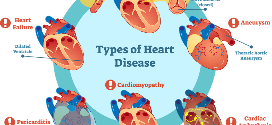 Types of heart disease