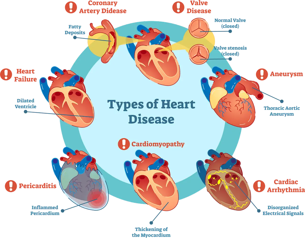 Types of heart disease