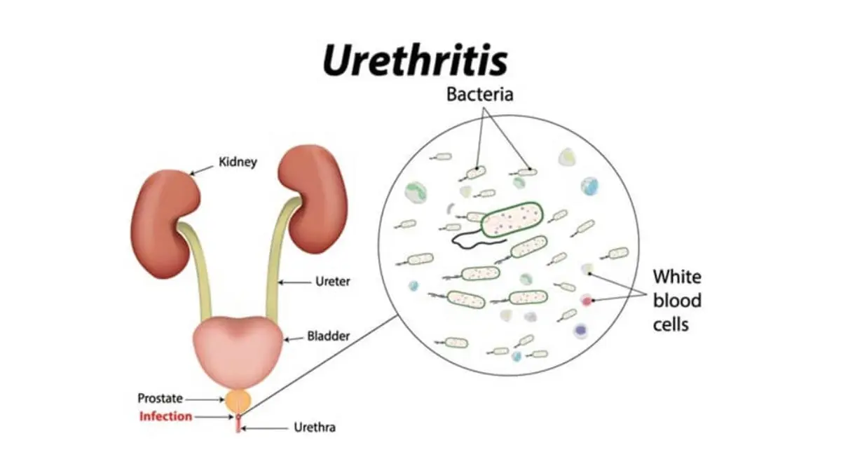 List of diets for illnesses