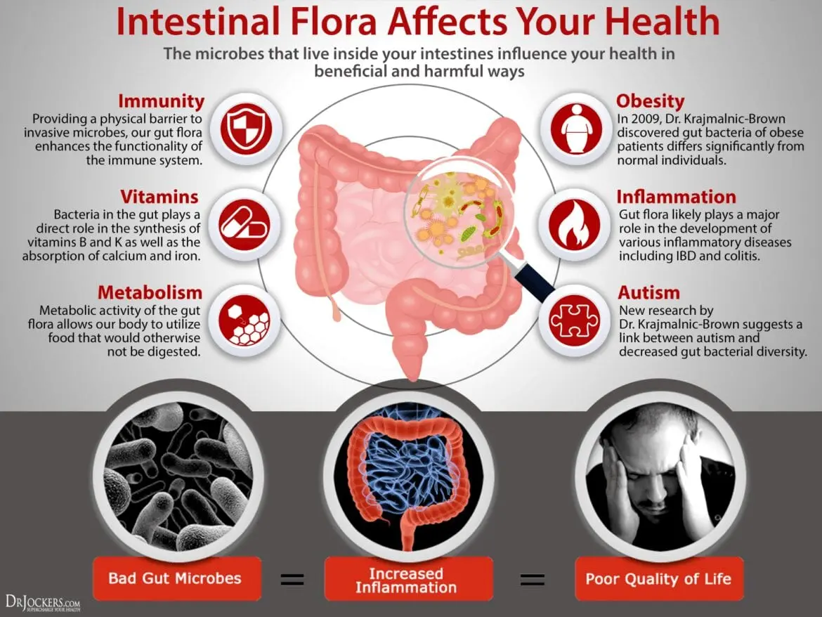What foods really improve gut microflora?