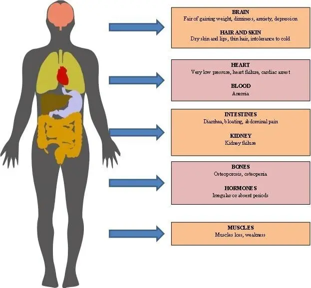 Anorexia: causes and consequences