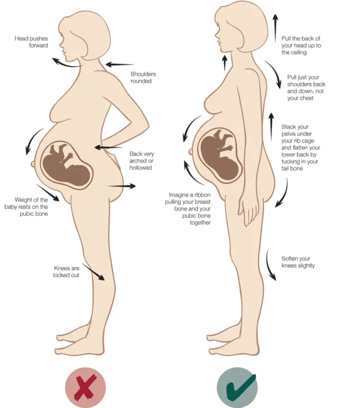 Back pain during pregnancy