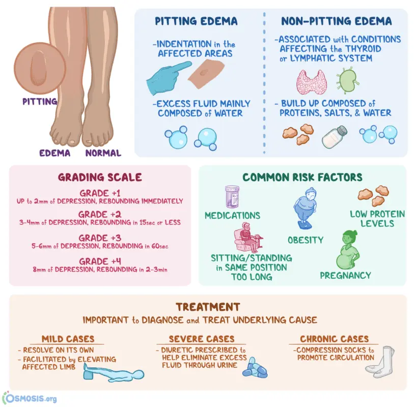 Causes of edema and how to remove excess water