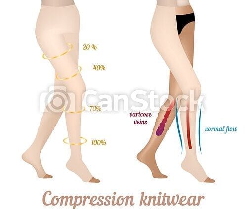 Compression knitwear for venous insufficiency