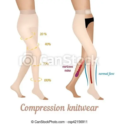 Compression knitwear for venous insufficiency