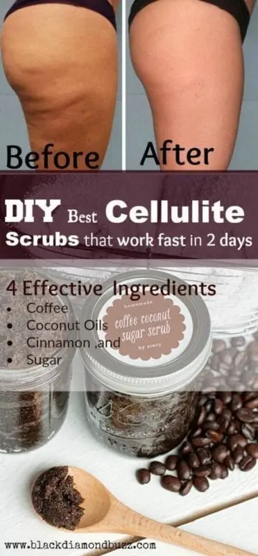 How to get rid of cellulite at home