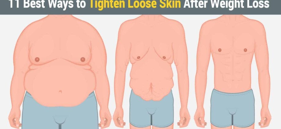 How to maintain the elasticity of the skin when losing weight