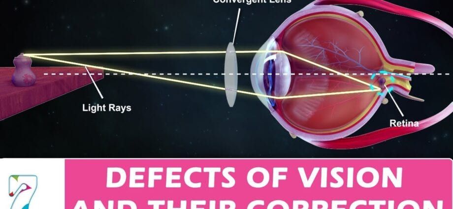 Vision and its correction