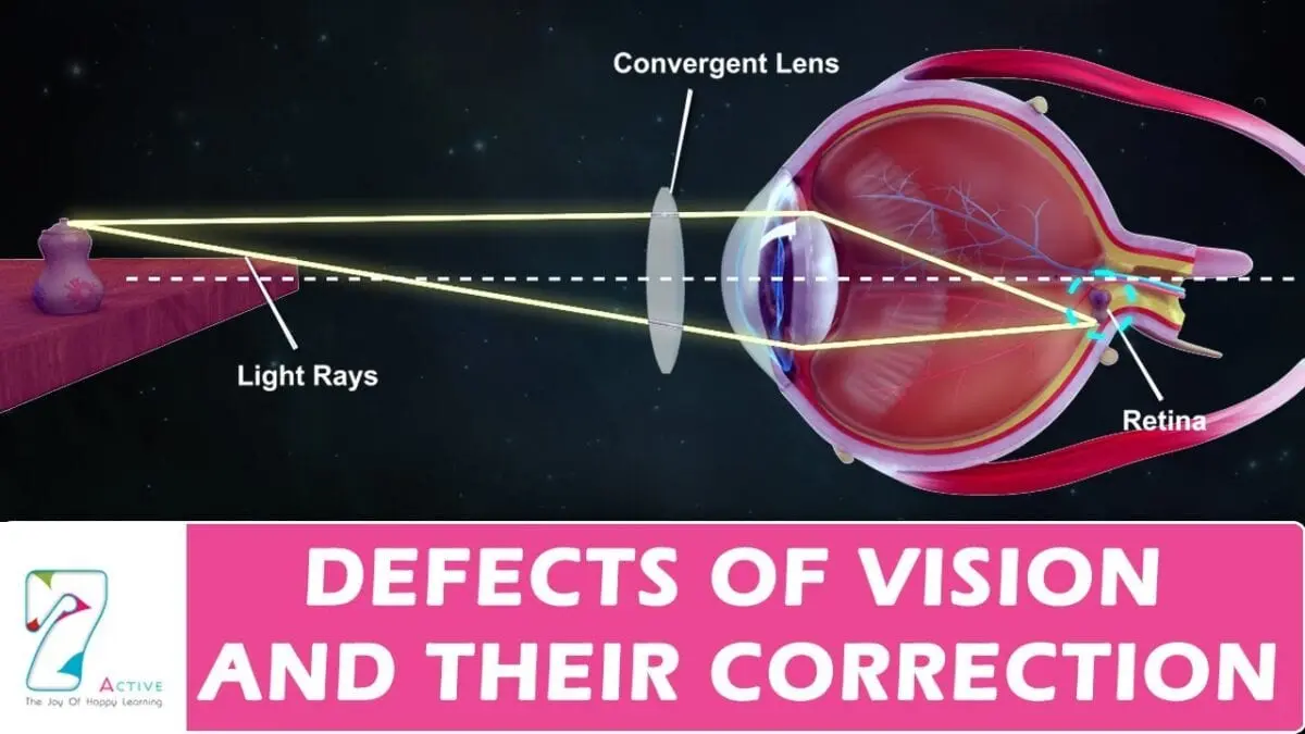 Vision and its correction