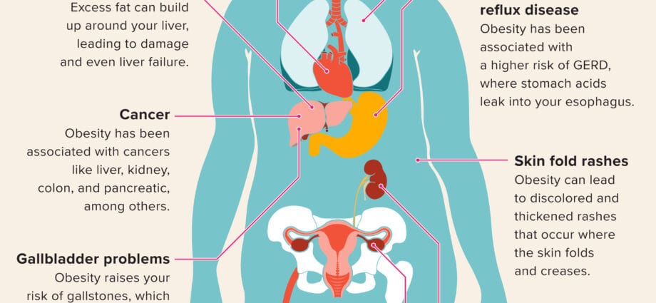 What diseases lead to excess weight?