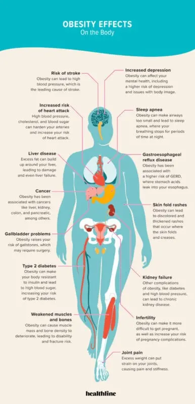 What diseases lead to excess weight?