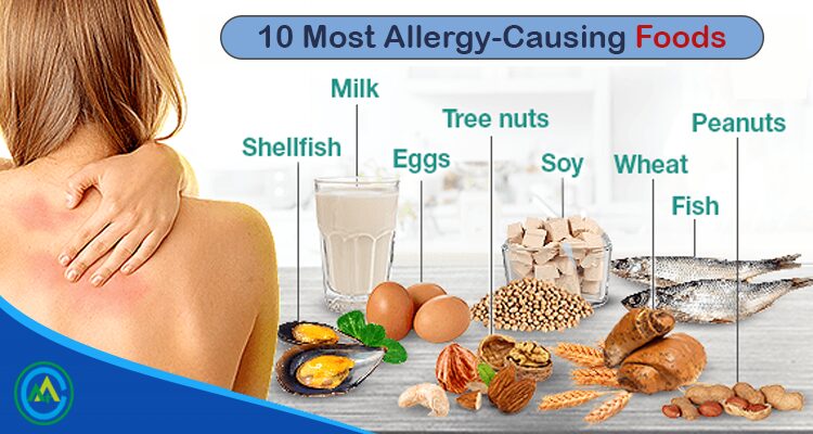 10 foods you are not allergic to