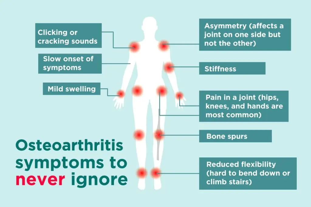 Symptoms of osteoarthritis (osteoarthritis)