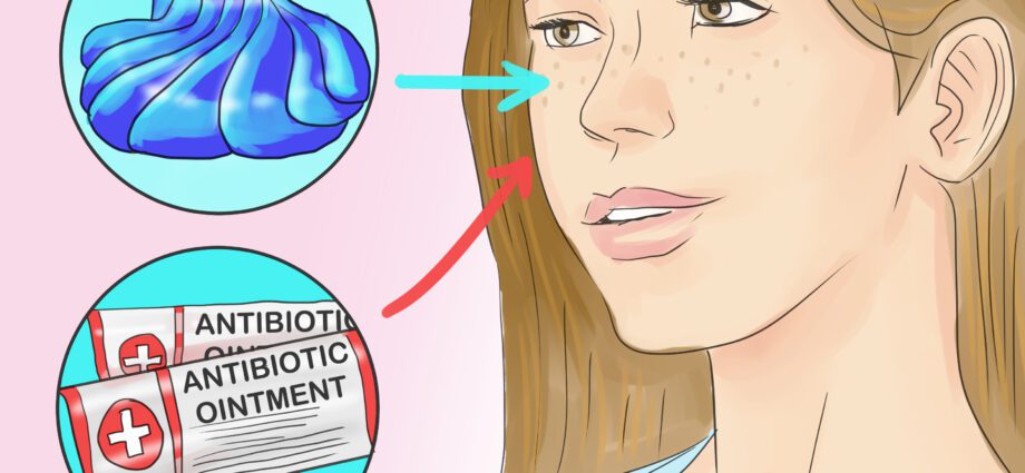 10 Modi Per Fà Freckles In Your Face