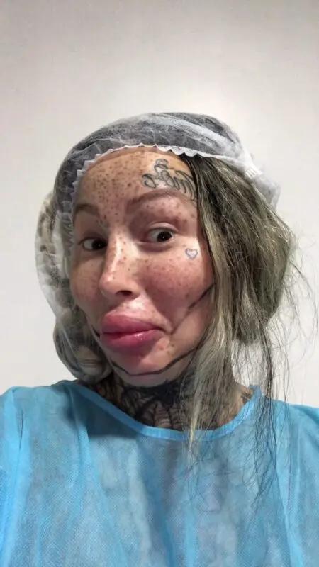 11 stars who nearly died after plastic surgery
