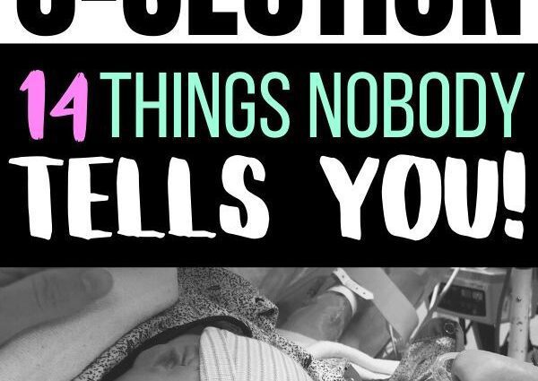 14 things every mom needs to know about caesarean